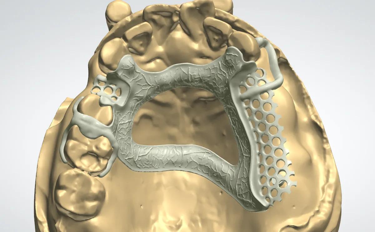 Digital dental workflow at Times Dental Lab