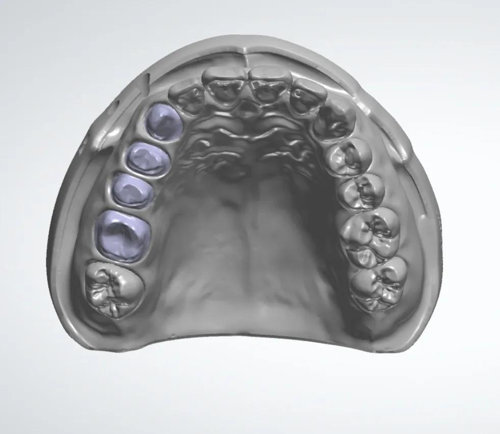 Digital Dental Workflow