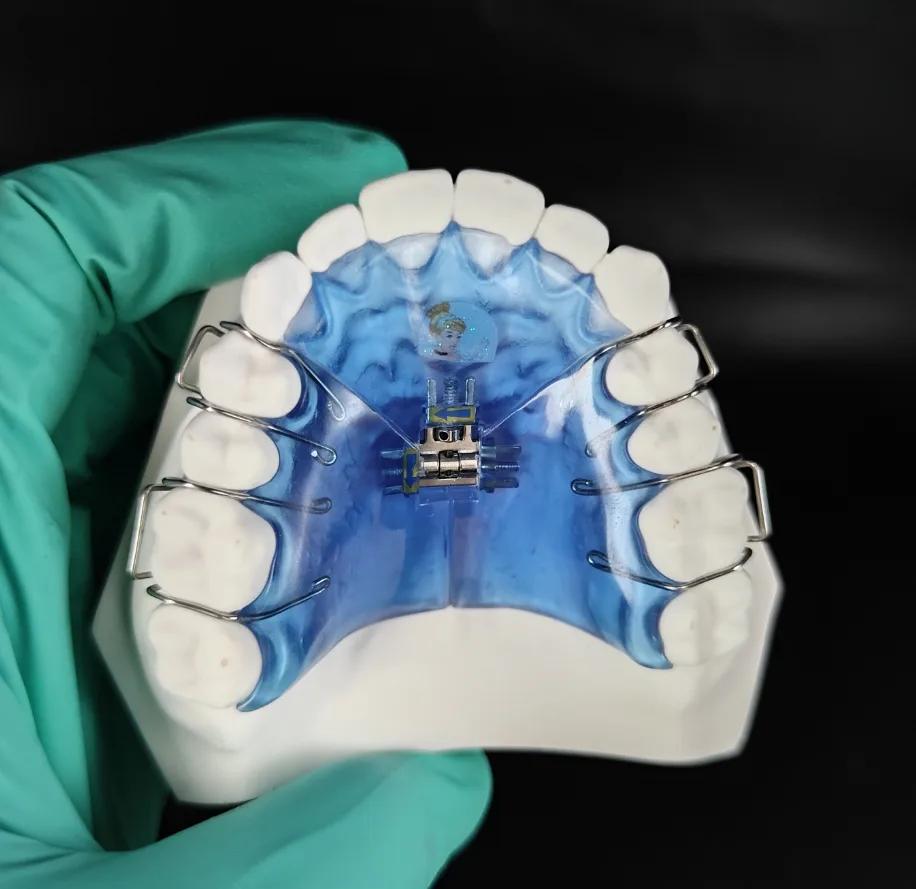 Orthodontic Appliances