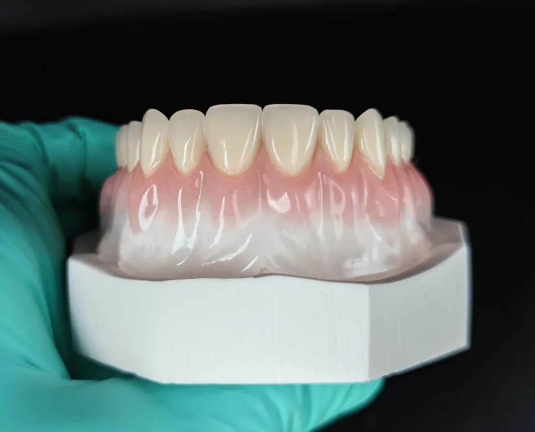 Removable Dentures