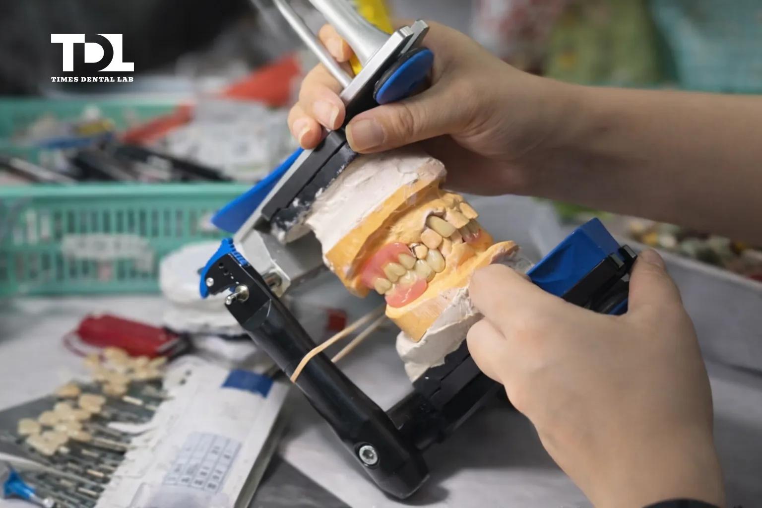 Dental lab quality control process