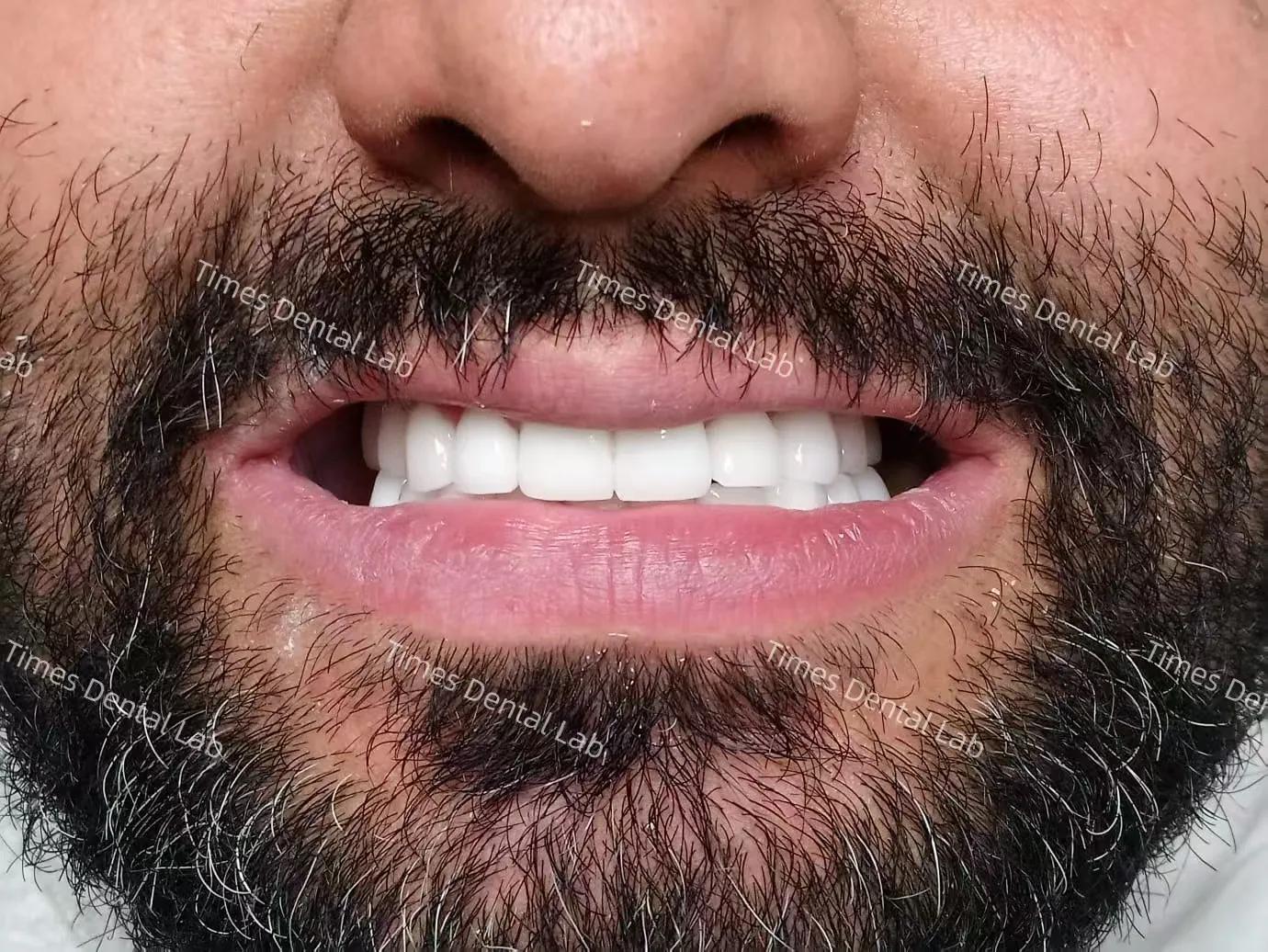 Dental lab resources image right