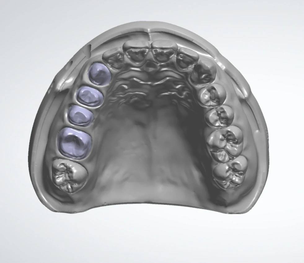 Model Design