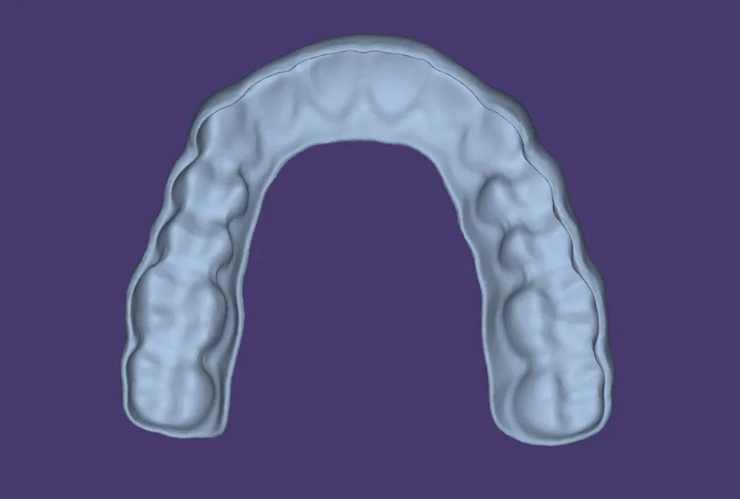 Splint Design
