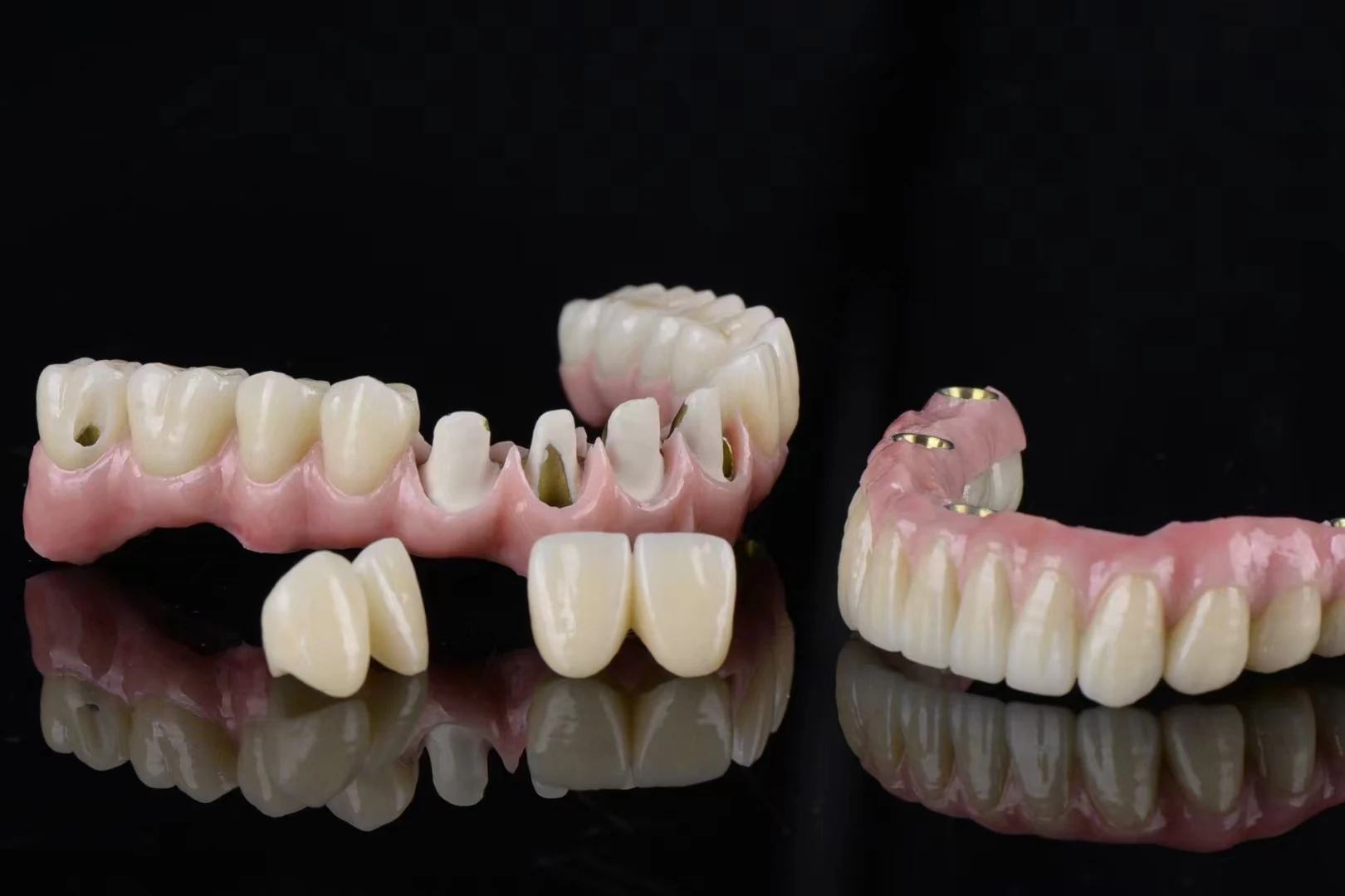 Implant Restorations
